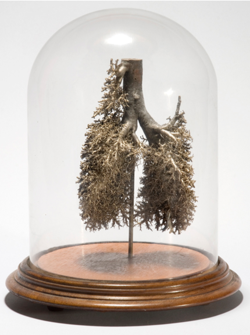 Corrosion cast of bronchi and trachea