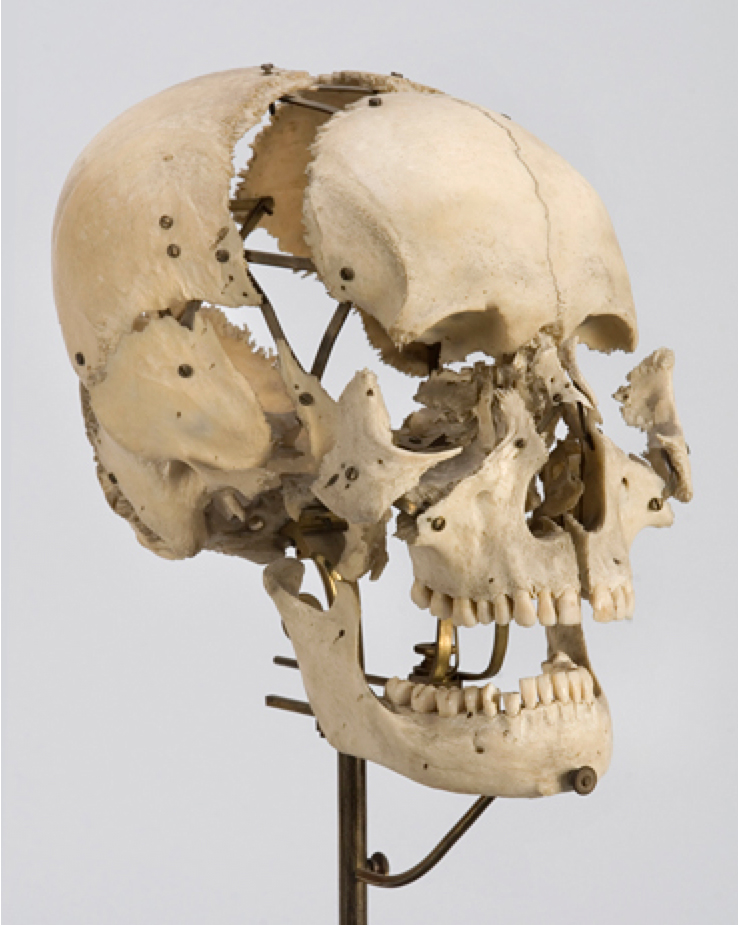 Mounted Beauchene skull