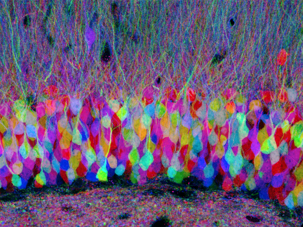 Brainbow
