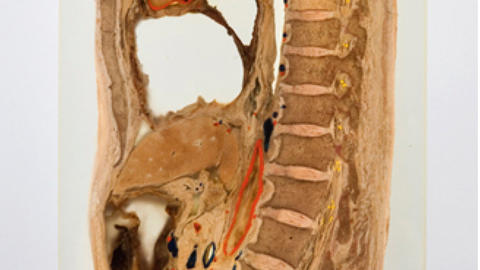 Sagittal Section of Human Spine Preserved in Arcrylic
