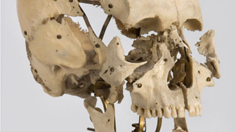 Mounted Beauchene skull