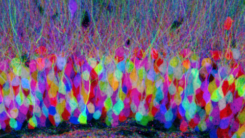 Brainbow